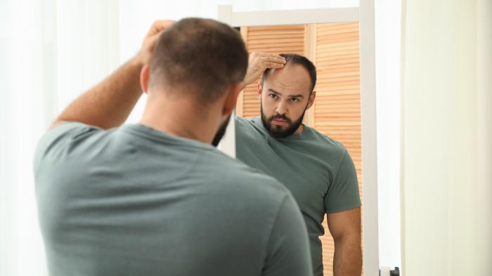 Мужчина с выпадением волос стоит перед зеркалом и смотрит на свою увеличивающуюся лысину.